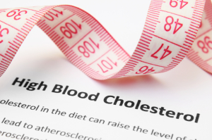 high cholesterol and thyroid